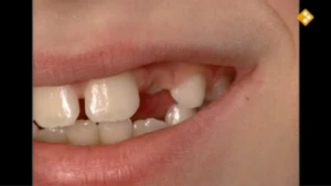 Een tandje meer