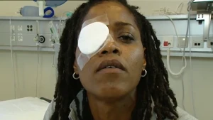 Een tandenborstel in je oog