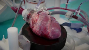 Een stukje hart uit de 3D-printer