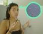 De hoofdhuidbacterie