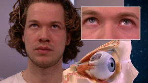 Een foto van Pascal die omhoogkijkt naast een groter gemaakte foto van Pascal's omhoogkijkende ogen. Onder de oogfoto is een voorbeeld van een menselijke oogbol in de oogkas te zien met oogspieren, weefsel en een stukje van de binnenkant van de oogbol.