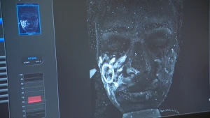 Een foto van een beeldscherm met een computerprogramma om menselijke huid dat door zonlicht verbrand is te kunnen zien. Op het scherm staan de tekst "UV Spots",  een beoordeling van 10 tot 100 en een donker gezicht van een mens met lichtblauwe plekjes.