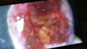 Foto van de darmen van een muis genomen door de huid heen.